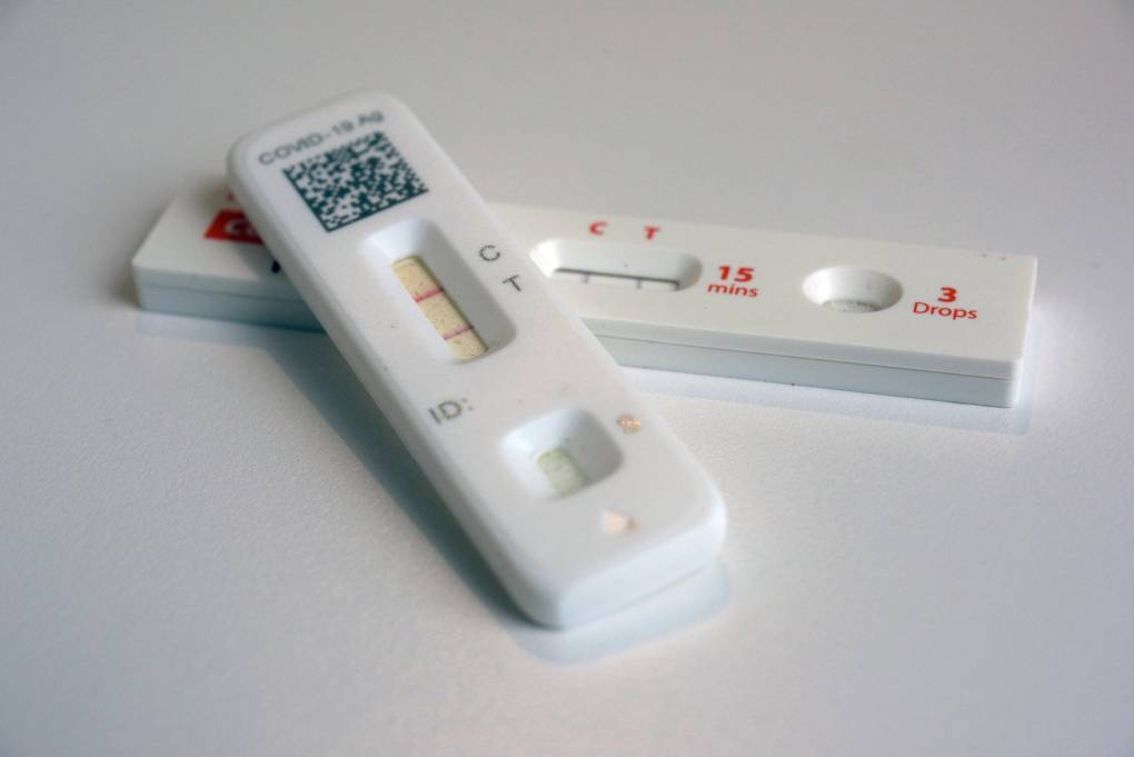 A closeup image of two COVID-19 antigen test results.